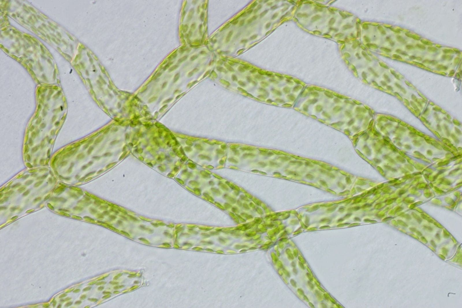Branching green threads of moss protonema under a microscope, the first growth from a sprouting moss spore, each cell packed with chloroplasts